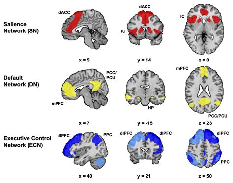 steel box as expression for the brain|The Creative Brain Under Stress: Considerations for Performance .